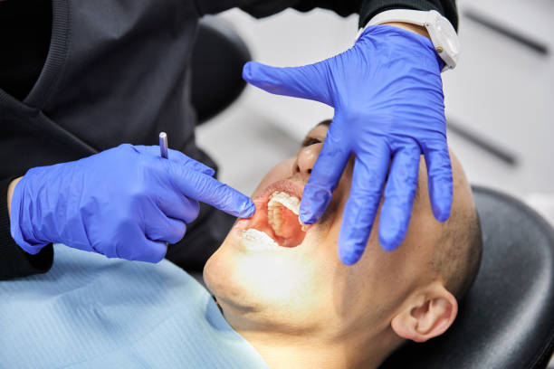 Best Emergency Dental Extractions in Garrison, TX