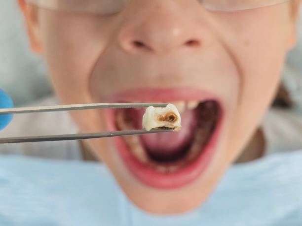 Best Weekend Emergency Dentist in Garrison, TX
